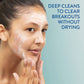 Gentle Clear, Clarifying Acne Cream Cleanser